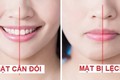 3 thói quen khiến khuôn mặt bị lệch, mất cân đối