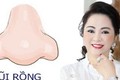 6 nét dị tướng của phụ nữ nhìn thấy xấu nhưng là tụ tài