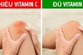 Những dấu hiệu cảnh báo bạn thiếu vitamin C trầm trọng