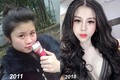 3 hotgirl MXH chi tiền tỉ "đập mặt xây lại", sinh con ra càng lớn càng đẹp lạ kì