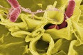 5 câu hỏi lớn về vi khuẩn Salmonella nguy hiểm