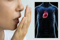 Vi khuẩn gây hôi miệng làm tăng nguy cơ mắc bệnh tim?
