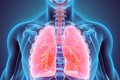 Bệnh bụi phổi gây loạt biến chứng: Điều trị có hiệu quả?