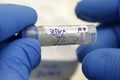 Bộ Y tế khuyến cáo triệu chứng phải xét nghiệm Zika