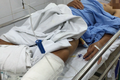Nguyên nhân mổ nhầm chân ở Bệnh viện Việt Đức là gì?
