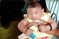 2 bé mắc chứng đầu nhỏ ở Đắk Lắk không phải do Zika