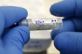 Danh sách 30 bệnh viện xét nghiệm Zika miễn phí tại TPHCM