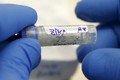 Thêm 5 trường hợp nhiễm virus Zika ở TP HCM