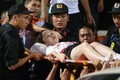 Fan nữ trúng pháo sáng CĐV Nam Định: Bỏng hoá chất nguy hiểm thế nào?