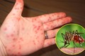 Số ca sốt xuất huyết tăng nhanh ở Hà Nội, phòng ngừa bằng cách nào?