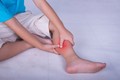 5 triệu chứng xuất hiện ở tay chân, khám huyết khối ngay còn kịp