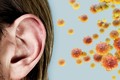 Giải mã bất ngờ về chứng “tai COVID-19” gây ám ảnh nhiều người