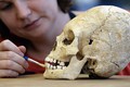 Nổi da gà kỹ thuật nắn dài hộp sọ của người La Mã cổ đại