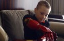 Em bé khuyết tật 7 tuổi được lắp cánh tay siêu nhân