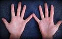 Bàn tay có 5 đặc điểm này bảo sao suốt đời chỉ làm "nô bộc"