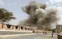 Liên quân Ả-rập không kích ở Yemen, hàng loạt dân thường thiệt mạng