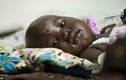Ảnh em bé sống sót kỳ diệu vụ máy bay rơi tại Nam Sudan