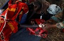 Hình ảnh đau lòng về nạn đói ở Nam Sudan