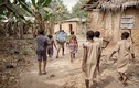 Cơ cực những đứa trẻ đáng thương ở Châu Phi 