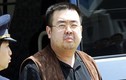 Vụ Kim Jong-nam: Mỹ cáo buộc Triều Tiên sử dụng vũ khí hóa học