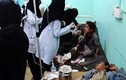 Hàng chục trẻ Yemen chết thảm sau khi trúng tên lửa Ả-rập Xê-út