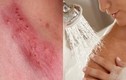 3 mẹ con nhiễm HPV, nguyên nhân vì vật thường dùng trong nhà tắm