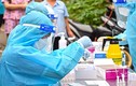 Bộ Y tế: Tăng cường giám sát, bảo đảm chất lượng xét nghiệm SARS-CoV-2