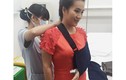Vợ Bình Minh bị tai nạn rạn nứt xương tay ngay trước Tết