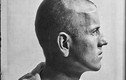 Hình ảnh gây ám ảnh về phẫu thuật não những năm 1900