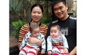 Vợ chồng quyết định sinh non để cứu cặp sinh đôi