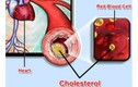 Kẻ thù âm thầm đang giết chết nhiều người trẻ tuổi