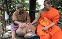 Người đàn ông Thái Lan khổ vì chân dị dạng to như chân voi