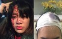 Xôn xao hình ảnh cô gái bị hai nam thanh niên đánh vỡ đầu