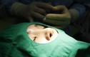 Sinh viên Trung Quốc đổ xô đi phẫu thuật thẩm mỹ để xin việc