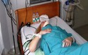 Nữ du khách Nga bị thương khi tắm biển do cá nhái cắn