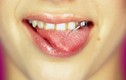 Những thói quen xấu phá hỏng hàm răng