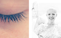 Bộ ảnh chân thực của cô gái mắc bệnh ung thư vú