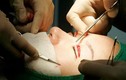Phẫu thuật thẩm mỹ - “cơn ác mộng” ở Hàn Quốc