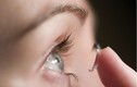 Mù mắt, trùng amip ăn nhãn cầu vì kính áp tròng