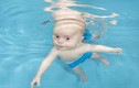 Bơi lội cứu sống bé sơ sinh bị tim bẩm sinh