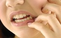 6 mẹo giảm đau răng cho bé không cần dùng thuốc