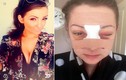 Thiếu nữ bị đánh gãy mũi bỗng nổi tiếng vì xinh đẹp