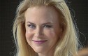 Rùng rợn khuôn mặt bóng nhờn vì botox của Nicole Kidman