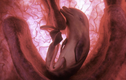 Bộ ảnh tuyệt đẹp về thai nhi của các loài động vật