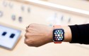 Apple Watch cứu sống bé trai 13 tuổi nhờ ứng dụng đặc biệt này