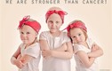 Bộ ảnh tuyệt đẹp của 3 cô bé mắc bệnh ung thư
