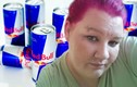 Cô gái mù mắt vì uống 28 lon Red Bull mỗi ngày