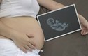 8 hoạt động ngạc nhiên em bé làm trong bụng mẹ