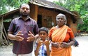 Hứng chịu “lời nguyền”, đại gia đình Ấn Độ sinh ra với bàn tay nhện