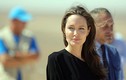 Điều ít biết về bệnh liệt nửa mặt Angelina Jolie mắc phải